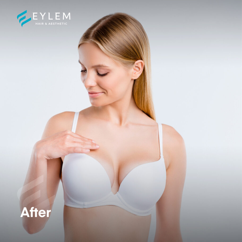 Breast-Lift-Surgery