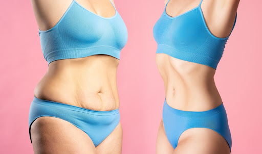 stomach reduction surgery | Methods, conditions and results