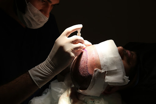 Do not hesitate, Contact us now via eylem clinic To provide you with everything you need about FUE hair transplant Procedure: Benefits, Side Effects, How It done